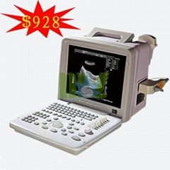Hot selling portable ultrasound equipment - MSLPU01