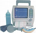 Single Fetal Monitor with CE Certificate 1