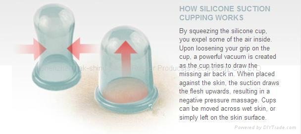 healthy medical silicon massage cupping cup 3