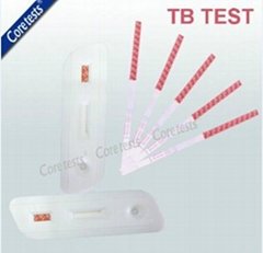 TB Tuberculosis test kit