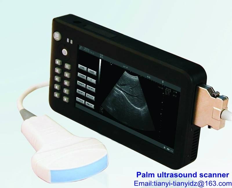 Palm type ultrasound scanner