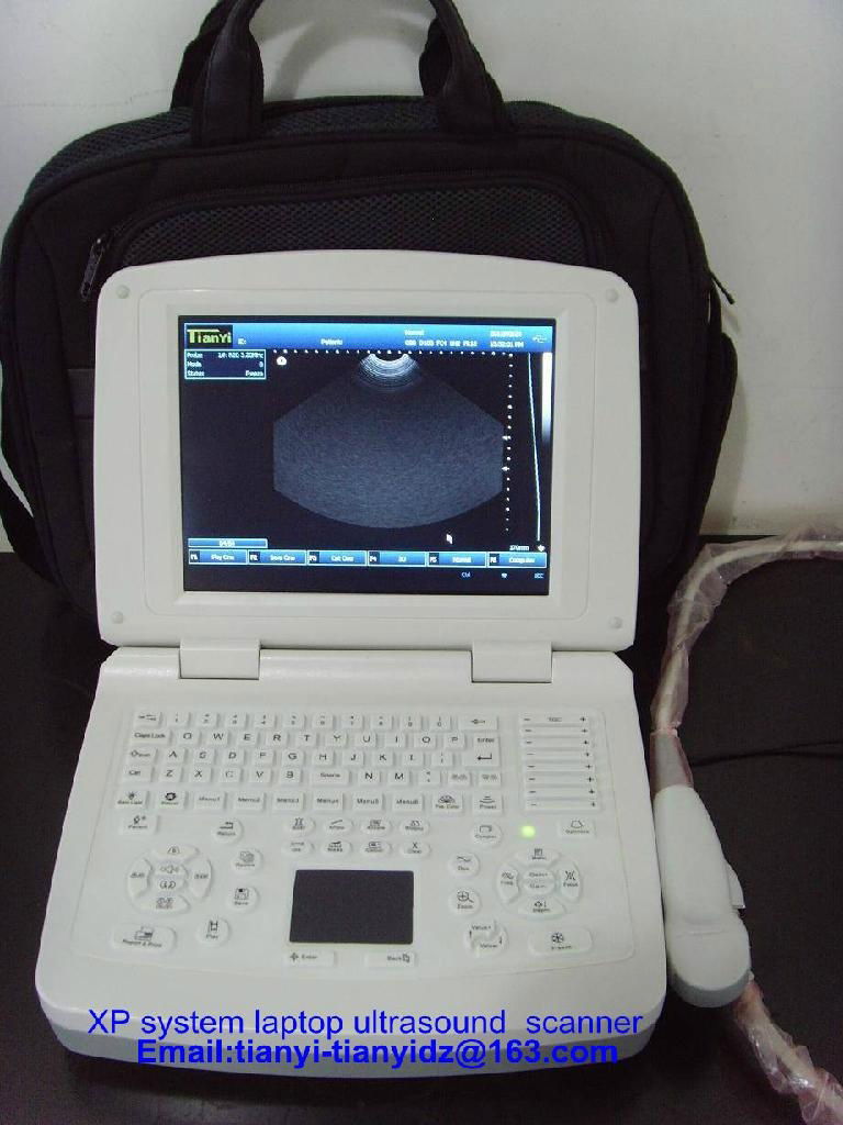 White laptop ultrasound scanner 