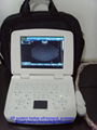 White laptop ultrasound scanner