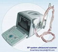 Portable ultrasound scanner 1