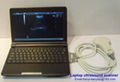 Laptop ultrasound scanner