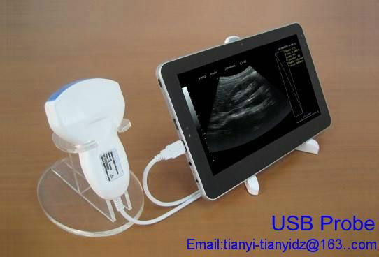 Tablet ultrasound scanner