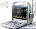 Portable color doppler ultrasound scanner