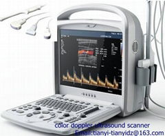 Portable color doppler ultrasound