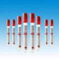 Vacuum Blood Collection Tube