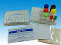 HEV ELISA TEST KIT 1