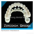 2013 hot zirconia porcelain crown/zirconia crowns price   1