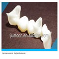 2013 hot zirconia porcelain crown/zirconia crowns price   2