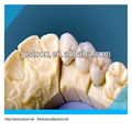 2013 hot zirconia porcelain crown/zirconia crowns price   3