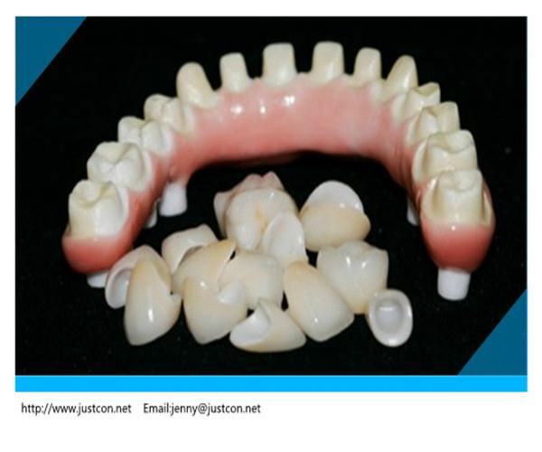 2013 hot dental all-ceramic zirconia crown/dental zirconia   2