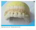 2013 hot dental Non-precious PFM denture/pfm dental crown denture   1