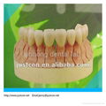 2013 hot dental Non-precious PFM denture/pfm dental crown denture   2