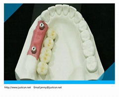 2013 hot dental implant /pfm implant crown /implant teeth 