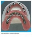 2013 hot Dental Precision Attachment/denture acrylic 1