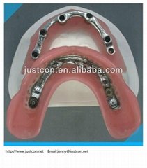 2013 hot Dental Precision Attachment/denture acrylic