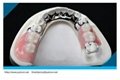2013 hot Dental Precision Attachment/denture acrylic 4