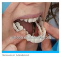 2013 hot snap on smile/dental braces