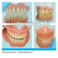 2013 hot Local acrylic denture/natural denture/dental supply   