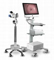 Digital Imaging System---Colposcope 1