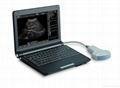 Portable/laptop ultrasound scanner
