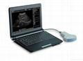 Portable/laptop ultrasound scanner 1