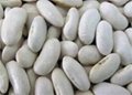 White Kidney Beans 2