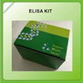 Human Annexin A1(ANXA1) ELISA Kit