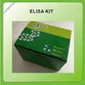 Rabbit Pancreatic triacylglycerol lipase(PNLIP)ELISA Kit