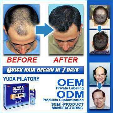 Herbal formula Yuda hair growth spray 100% safe and effective