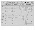 Six Channel ECG electrocardiograph 3