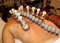 Rubber cupping set 5