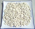 white kidney bean 1