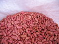 Light red kidney bean 1