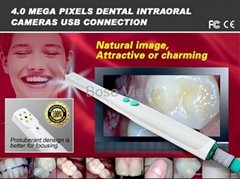 New Brand 4M Pixels Dental Intraoral Camera USB Connection(HK780)