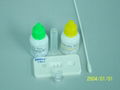 Chlamydia Rapid Test Kit