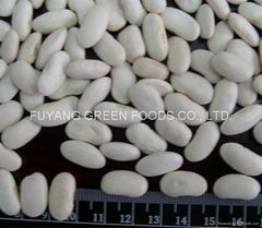 White kidney bean/Chinese kidney bean/dry bean/black kidney bean/mung bean