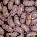 light speckled kidney beans