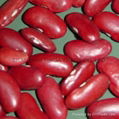 red beans 1