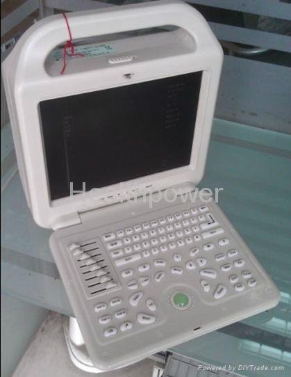 Laptop vet ultrasound scanner for the big and small animals