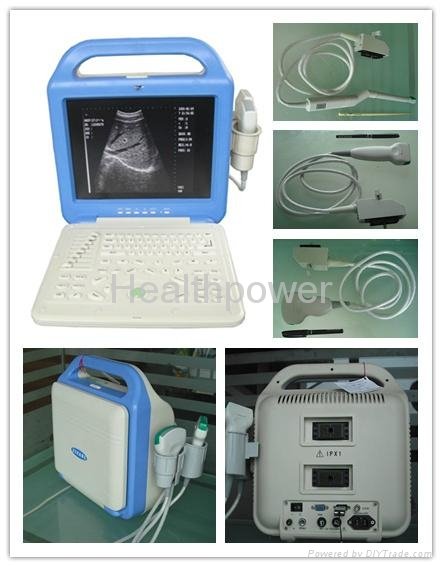 NEW laptop veterinary ultrasound with the rectal probe best-seller 3