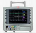 Portable CTG monitor NEW Fetal Monitor