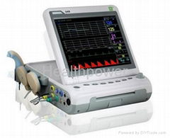 Best-seller Portable Fetal Monitor CTG monitor