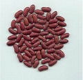 dark red kidney beans 1