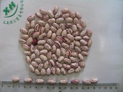 Light speckled kidney beans