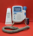 fetal doppler 2