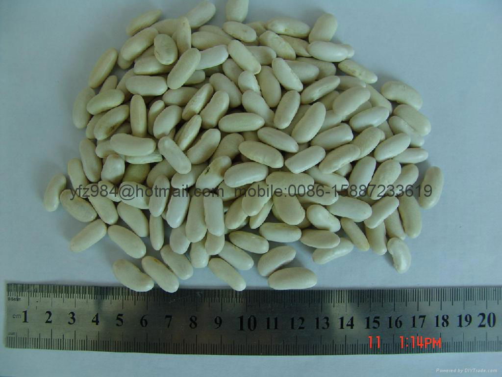 white kidney beans 3